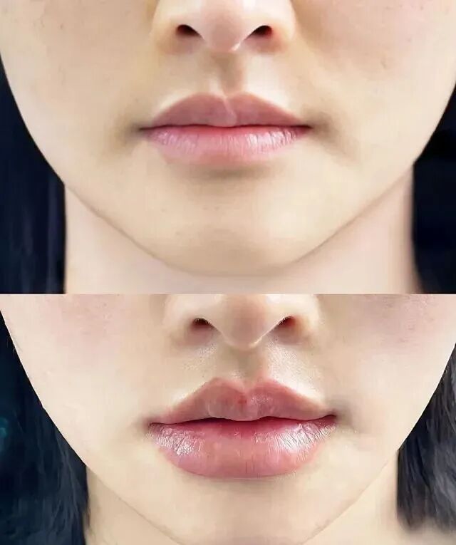 口周年轻化 - 小红书搜索