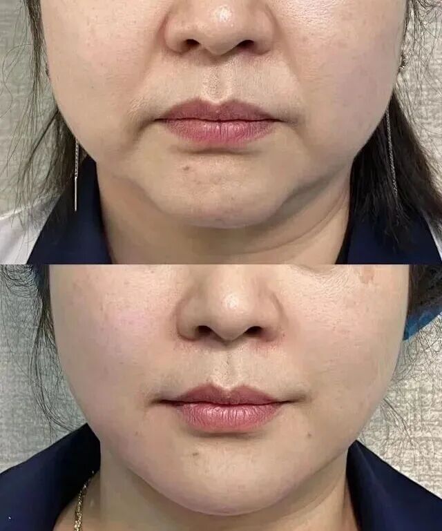 美业案例 - 小红书搜索