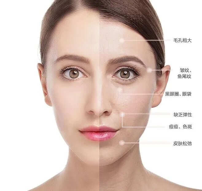 美容 祛痘 模特 美容美体 欧美模特  美妆内的花瓣采集图片-Rogers_Hua