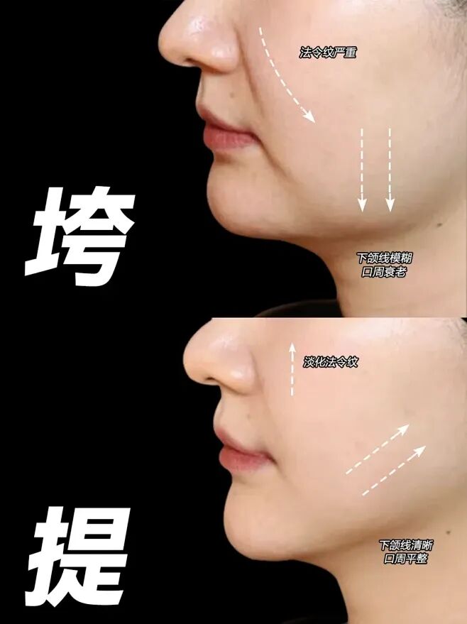 高阶K衰思路减龄10岁的下颌线 - 小红书